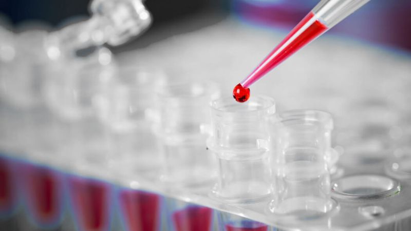 Liquid Biopsy là gì và được thực hiện như thế nào? 1