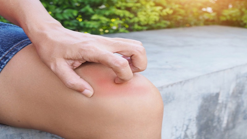 Lo lắng và ngứa ngáy xảy ra đồng thời: Nguyên nhân và giải pháp 1