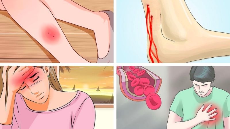 Loài rắn nào độc nhất Việt Nam và được mệnh danh là mìn sống? 3