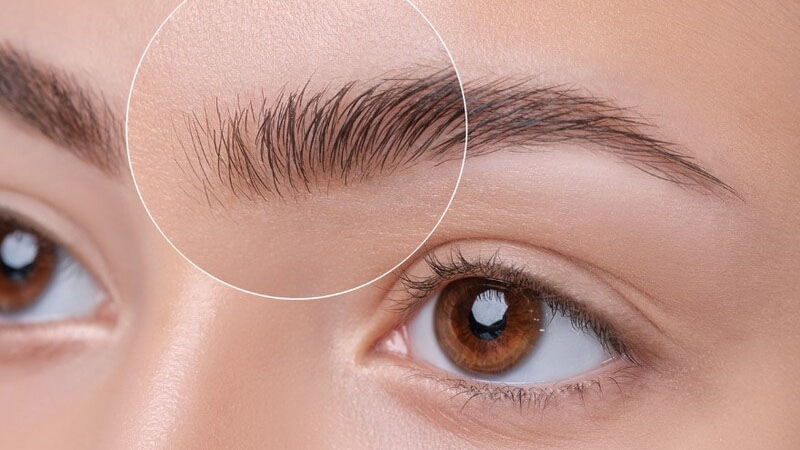 Lông mày mọc ngược là gì? Làm sao xử lý? 2