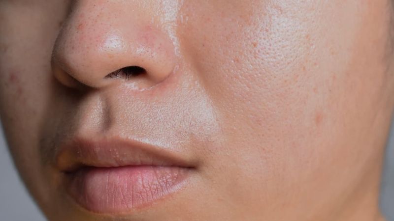 Lựa chọn loại đồ uống gì cho da bớt nhờn? 1