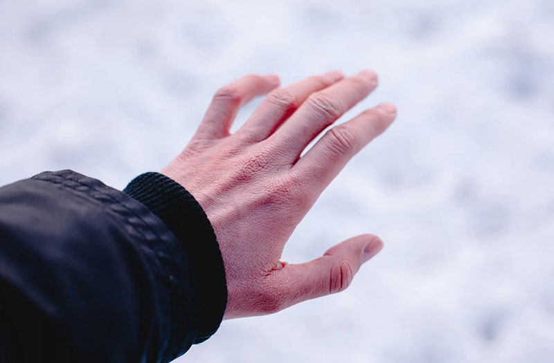 Lưu lại ngay cách sơ cứu bỏng lạnh ai cũng nên biết 1