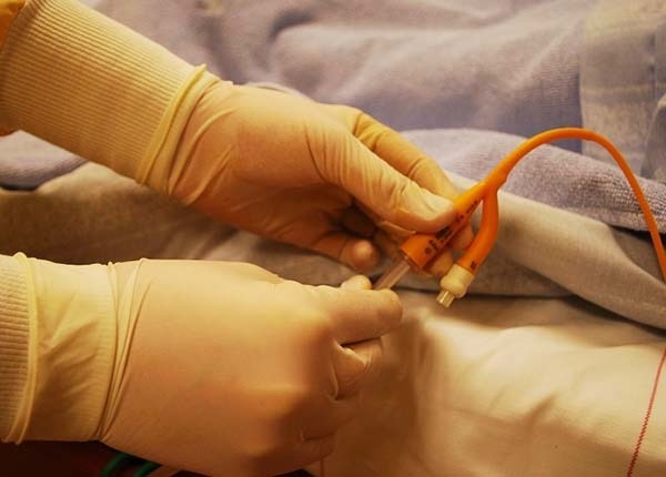 luu-y-truoc-khi-tien-hanh-rua-bang-quang 3.jpg