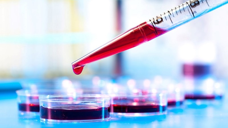 m-z-la-gi-ung-dung-trong-chan-doan-lam-sang 2