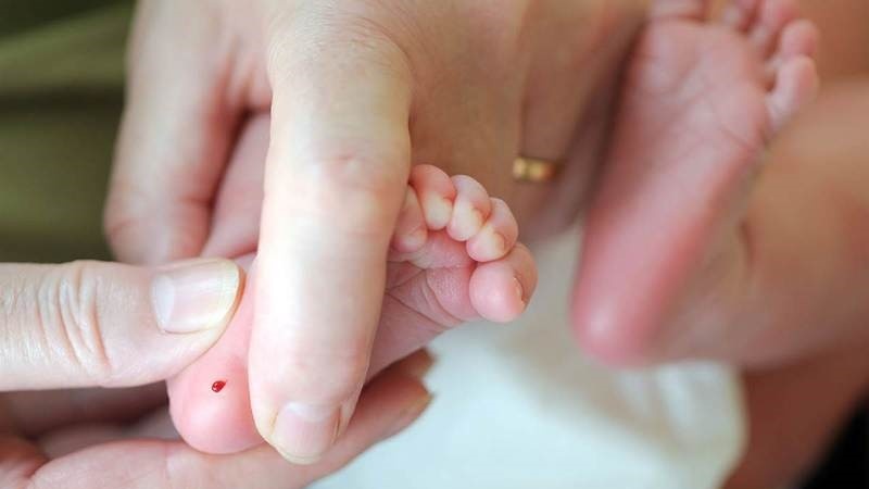 m-z-la-gi-ung-dung-trong-chan-doan-lam-sang 4