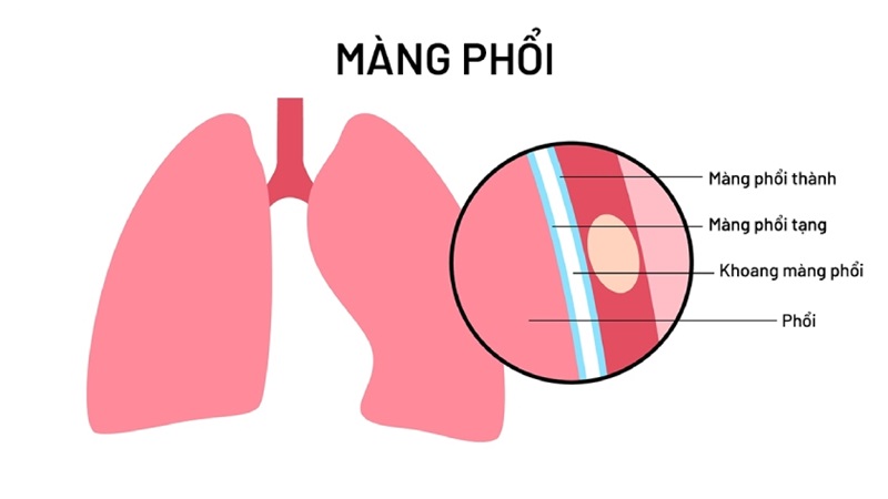 Màng phổi: Cấu tạo, chức năng và các bệnh lý thường gặp 2