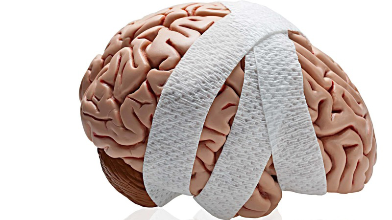 Mất nhận thức là gì? Cách chẩn đoán và điều trị 4