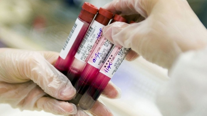 Máu toàn phần là gì? Cách bảo quản và sử dụng 2