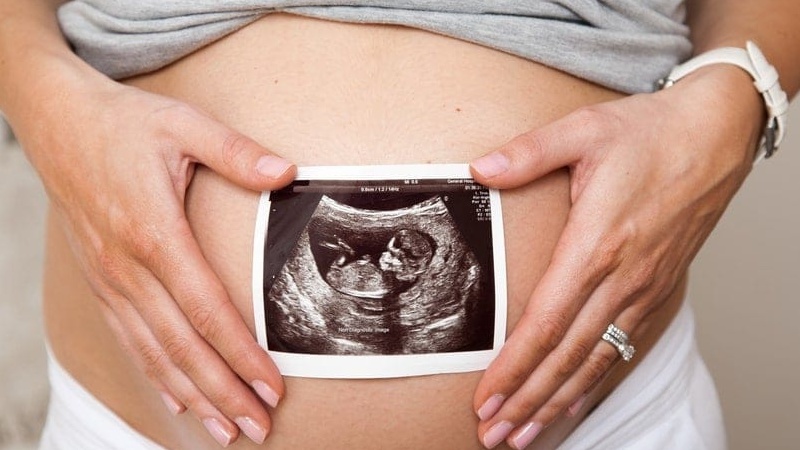 Siêu âm giúp phát hiện tình trạng dư ối và đa ối 2