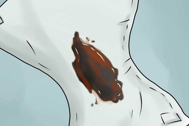 Mẹ bầu mang thai 34 tuần ra dịch màu nâu có sao không? 1