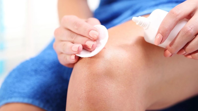 Mèo đã tiêm phòng dại cắn có sao không và cách xử lý 2