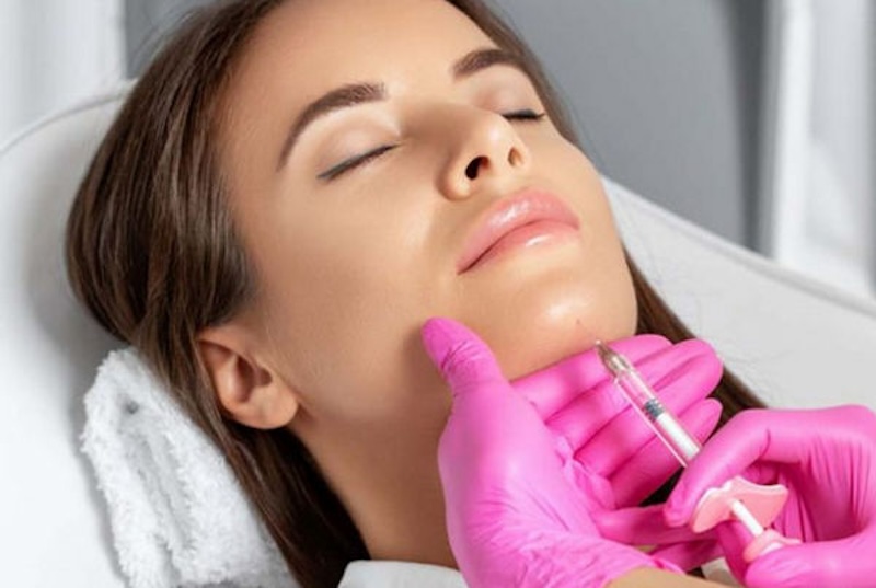 Meso khác filler phải không? Giải đáp từ chuyên gia 3