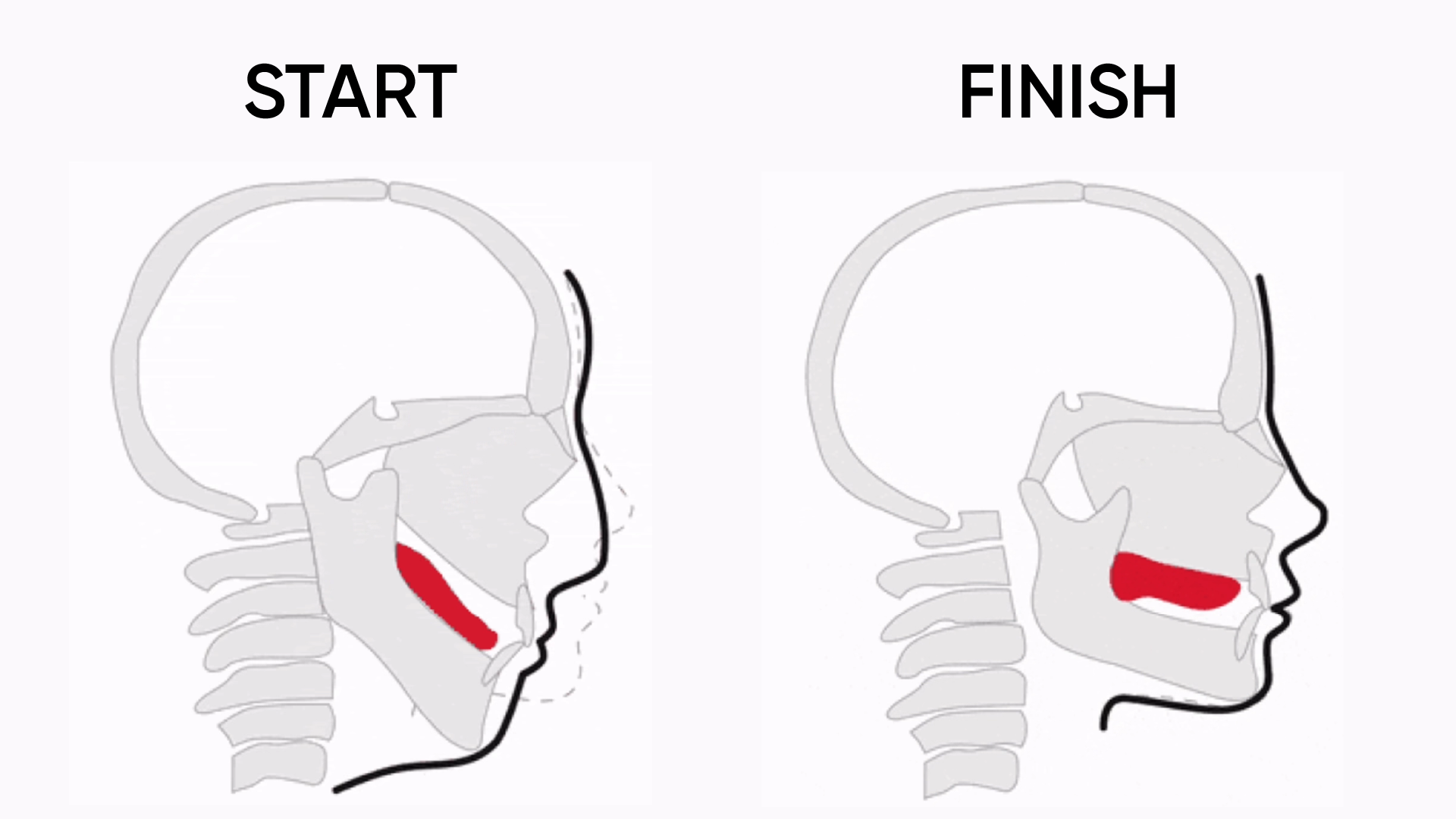 Mewiing Tutorial Các dấu hiệu tập mewing sai cách mà bạn cần chú ý - Nhà thuốc FPT Long Châu