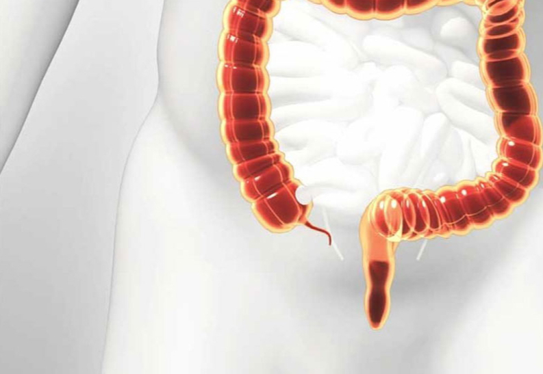 Mổ ruột thừa bao lâu thì đi xe máy được? Khi nào thì cơ thể phục hồi hoàn toàn? 2