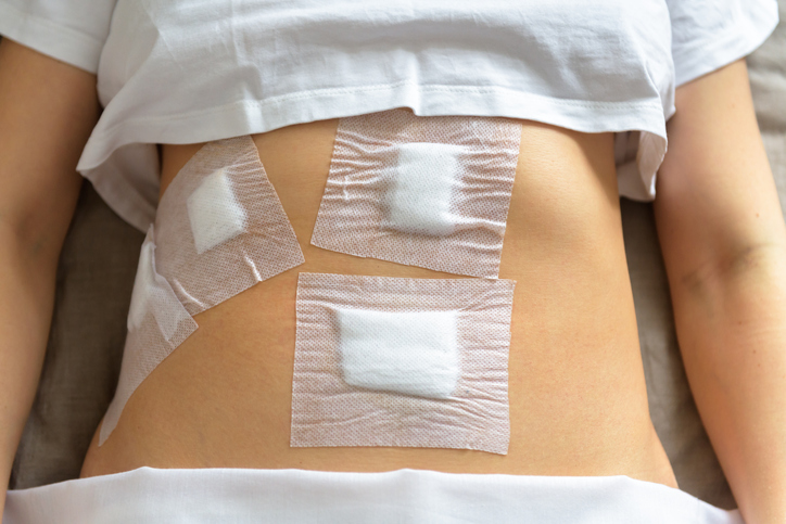 Mổ ruột thừa bao lâu thì làm việc nặng được? Những lưu ý khi vận động 2