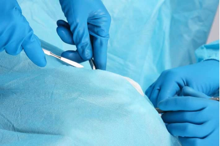 Mổ thoát vị bẹn có nguy hiểm không? Các phương pháp điều trị cho bệnh nhân 4