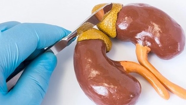 mo-u-tuyen-thuong-than-nhung-dieu-can-biet 2