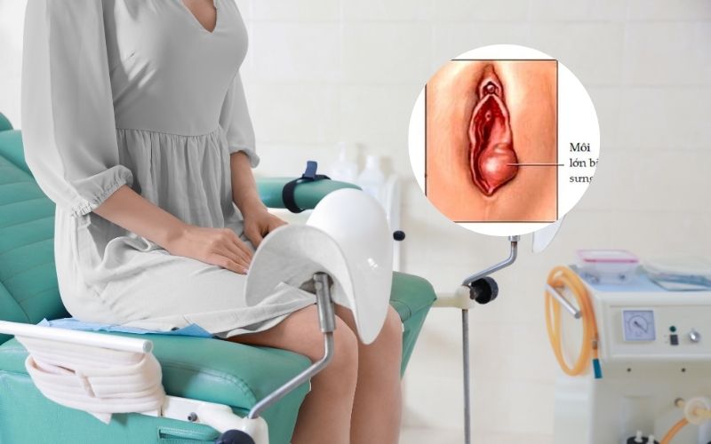 Môi âm hộ và những thông tin phái đẹp nên biết 3