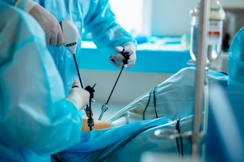 Mọi điều cần biết về cắt tuyến mồ hôi nách 4