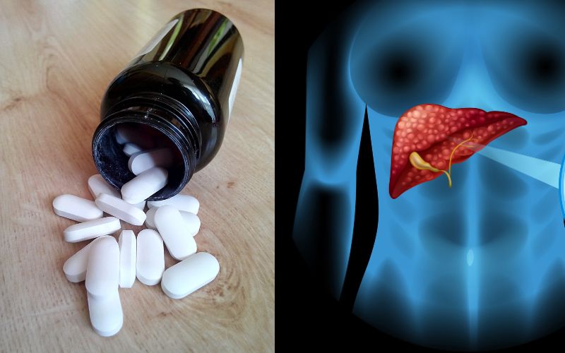 Thuốc giảm đau và tổn thương gan có mối liên hệ mật thiết với nhau
