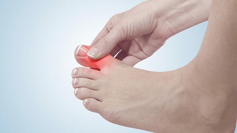 mot-so-benh-tat-lien-quan-den-he-van-dong-dang-luu-y 3