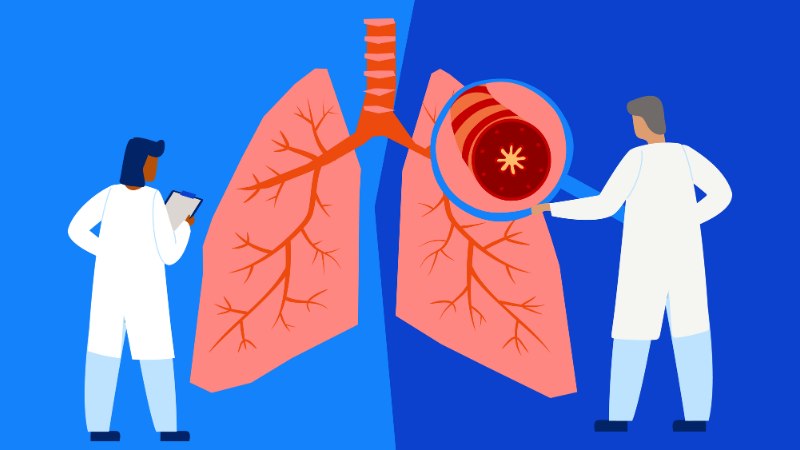 Một số cách giảm ho có đờm lâu ngày tại nhà 2