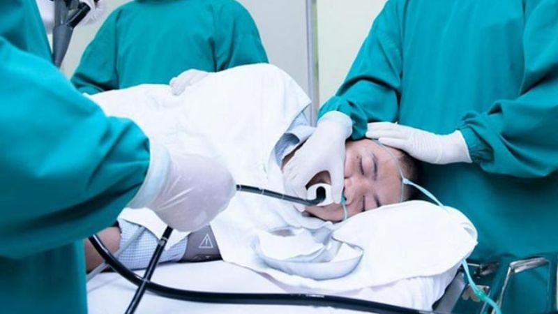 Một số phương pháp nội soi dạ dày không đau hiện nay 2