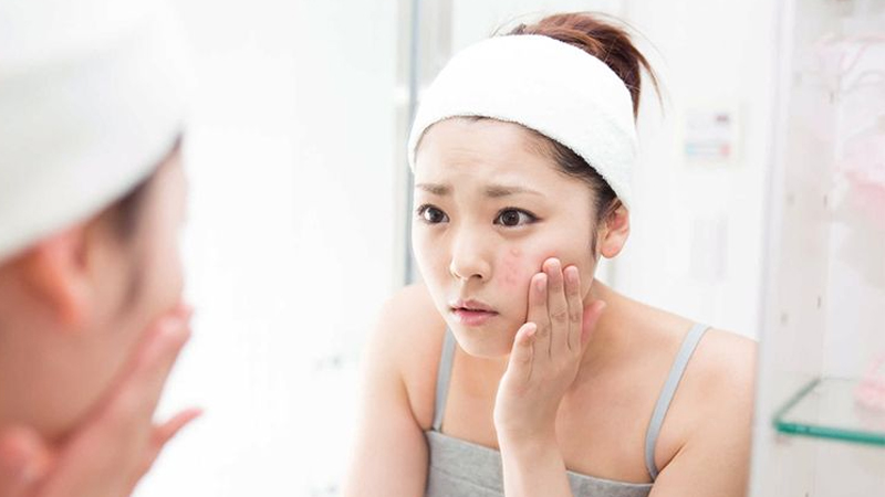 Mụn bọc là mụn như thế nào? Các dấu hiệu nhận biết mụn bọc 3