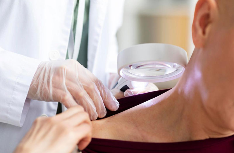 Mụn nước là gì? Cách điều trị hiệu quả 5