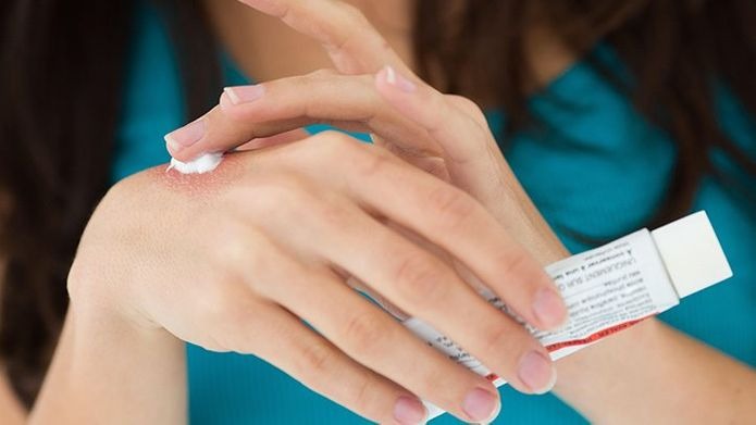 nam-da-tinea-la-gi-nguyen-nhan-va-trieu-chung-nam-da-tinea 1.jpg