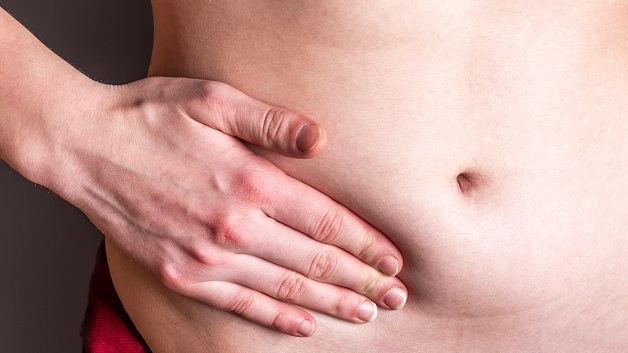 Thoát vị bẹn là gì? Vì sao nam giới bị thoát vị bẹn nhiều hơn nữ giới? 2