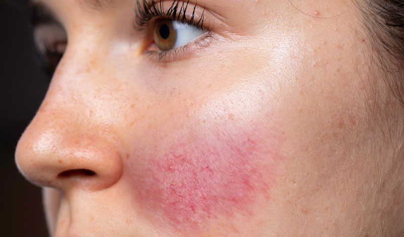 Natrihidroxit là gì? Ứng dụng của Natrihidroxit trong chăm sóc da 1