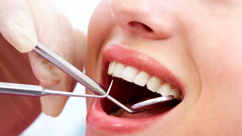 Nên nhổ răng khôn ở bệnh viện hay phòng khám? 4