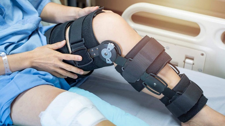 Nẹp đầu gối là gì? Tác dụng, công dụng và cách sử dụng 2