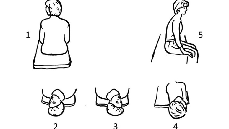 Nghiệm pháp Epley: Phương pháp điều trị cơn chóng mặt kịch phát lành tính 2