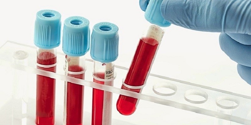 nghiem-phap-ruou-dieu-tri-benh-ly-dong-mau-rai-rac-noi-mach 1.jpg