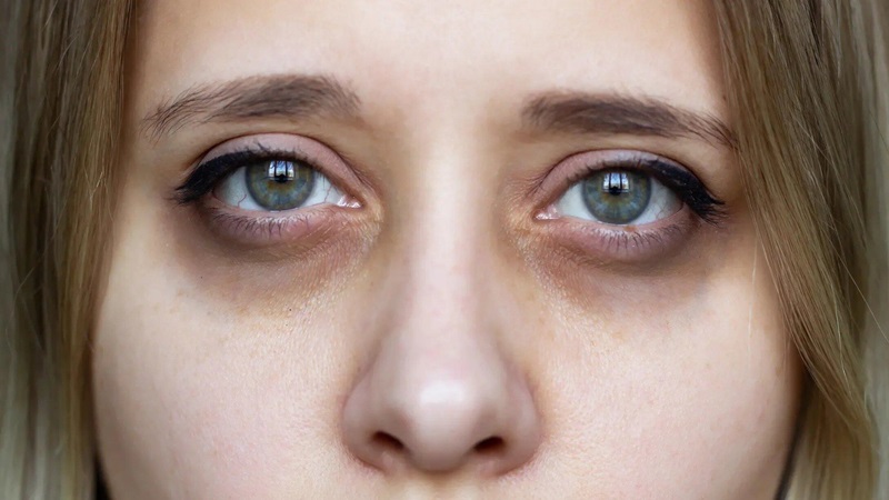 Ngủ sớm có hết thâm mắt không? Tiết lộ bất ngờ dành cho bạn 1