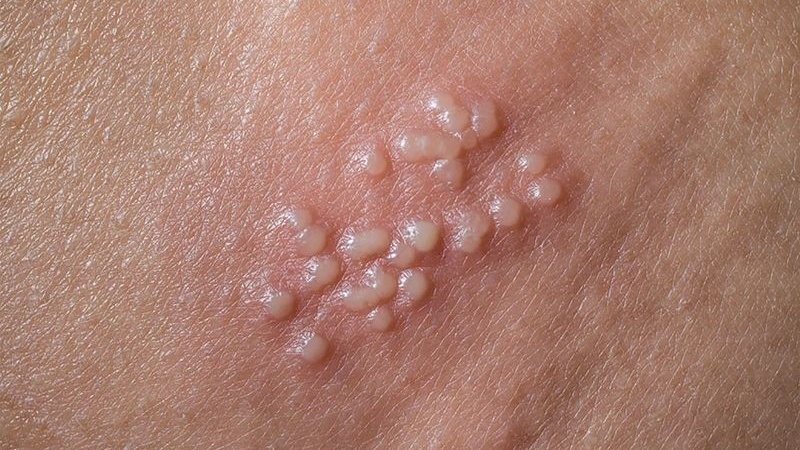 ngua-duong-vat-ve-dem-nguyen-nhan-do-dau-cach-khac-phuc 2