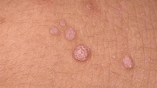 ngua-duong-vat-ve-dem-nguyen-nhan-do-dau-cach-khac-phuc 3