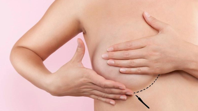 Ngực phụ nữ sau sinh thay đổi như thế nào? 4