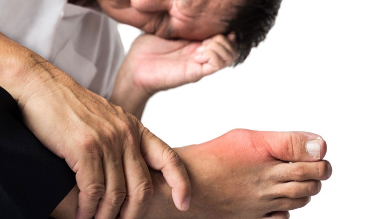 Người bị bệnh gút có uống được Glucosamine không? 2