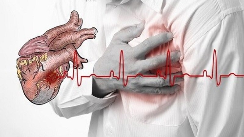 Nguy cơ nhồi máu cơ tim thành dưới và cách bảo vệ trái tim của bạn1