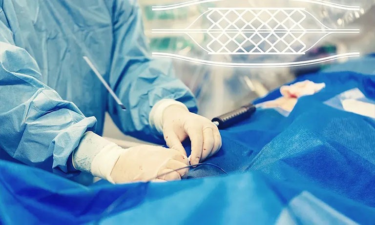 nguyen-ly-chup-mach-so-hoa-xoa-nen-dsa 3.jpg