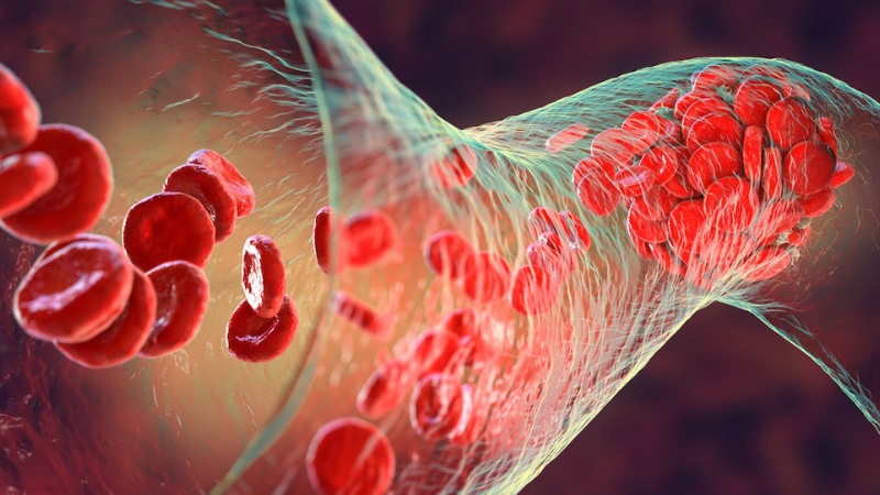 Nguyên nhân gây ban xuất huyết và cách phòng ngừa 2