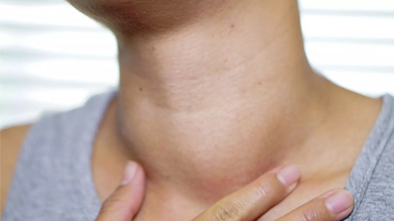 Nguyên nhân bệnh tuyến giáp gây tăng cân và cách khắc phục 1