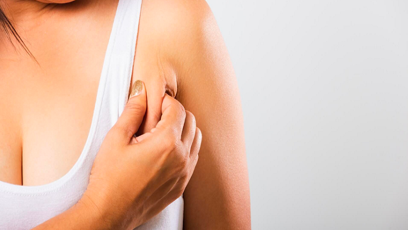 nguyen-nhan-gay-mo-nach-nhieu-va-cach-khac-phuc-hieu-qua 1.png