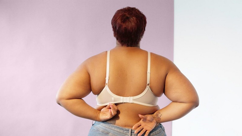 Nguyên nhân gây mỡ nách nhiều và cách khắc phục hiệu quả 2