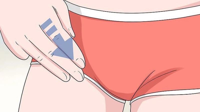 Nổi hạch ở háng trẻ em: Nguyên nhân và triệu chứng thường gặp 1