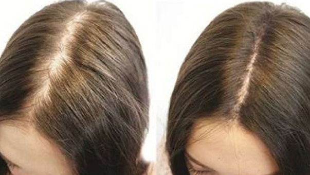 nguyen-nhan-khien-ban-bi-hoi-dau-khi-con-tre-3 Cropped (1).jpg