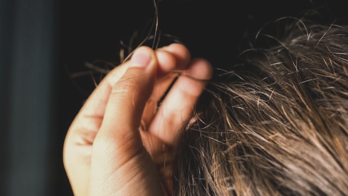 nguyen-nhan-nao-dan-den-rung-toc-o-tre-em-6-tuoi 2